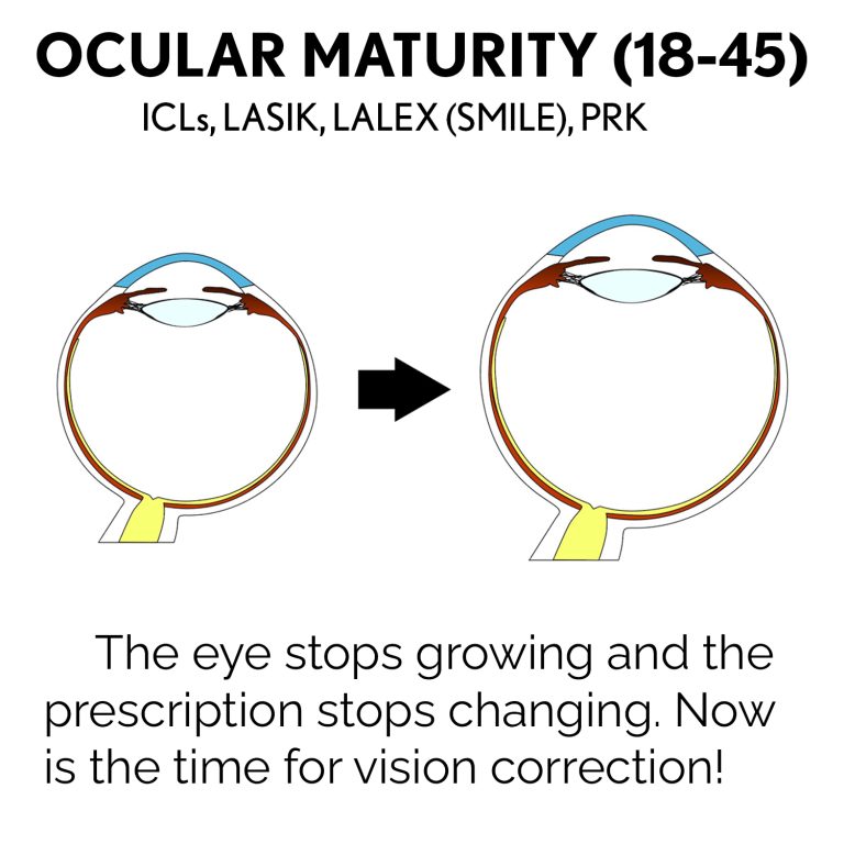 Ocular-Maturity